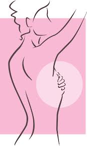 breast cancer