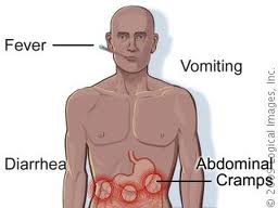 symptoms