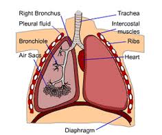 asthma