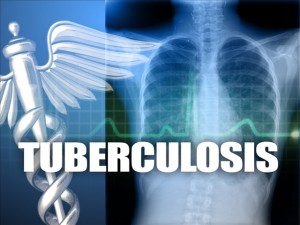 Tuberculosis7