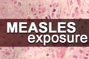 measles
